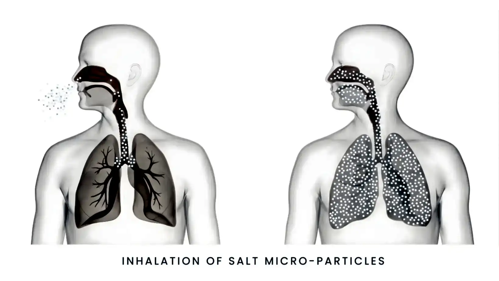 Inhalation of salt micro particles by luxpool